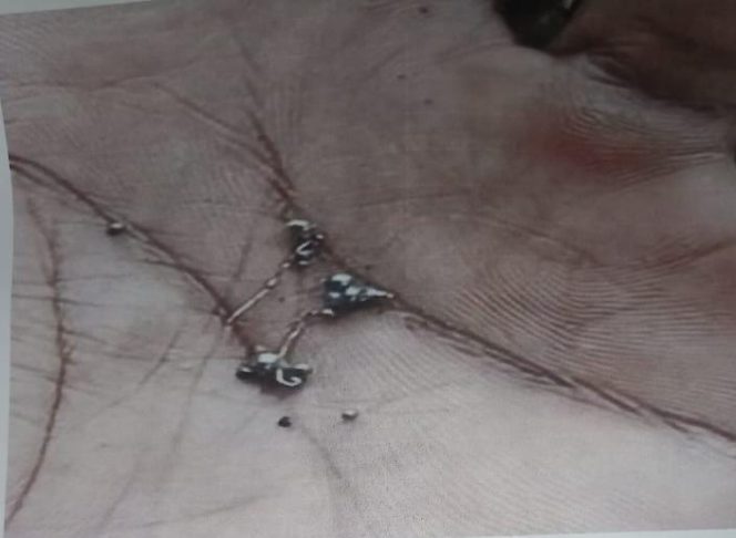 
					Peneliti Temukan Timah Digunung Madina, Kini Warga Sambut Kesejahteraan