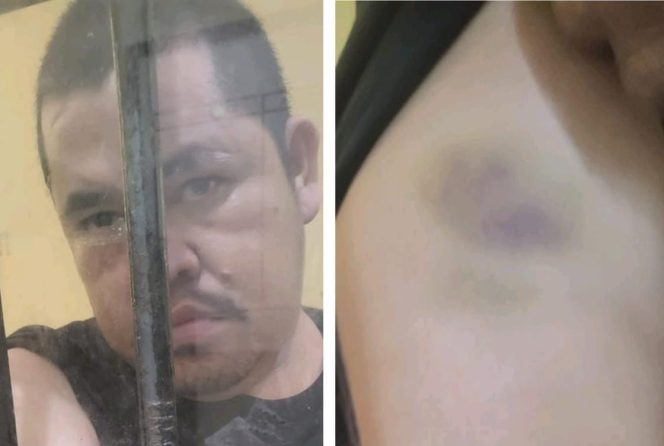 
					Tahanan Babak Belur di Polres Pelalawan: Kriminalisasi atau Penegakan Hukum?